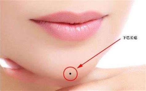 下巴有痣好不好_下巴有痣图解,第5张 下巴有痣好不好_下巴有痣图解,第5张